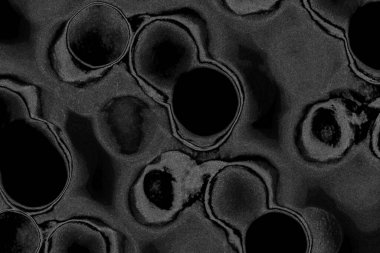 Çizik ve çatlaklarla dolu pis bir doku.