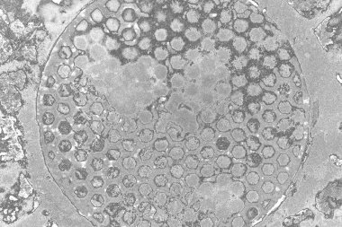 Çizik ve çatlaklarla dolu pis bir doku.