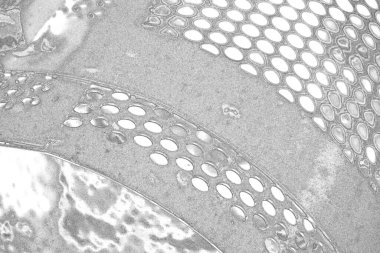 Çizik ve çatlaklarla dolu pis bir doku.