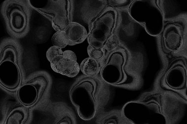 Çizik ve çatlaklarla dolu pis bir doku.