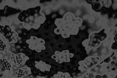 Çizik ve çatlaklarla dolu pis bir doku.