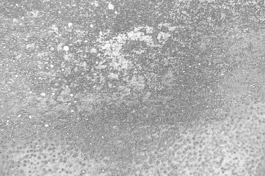 Çizik ve çatlaklarla dolu pis bir doku.