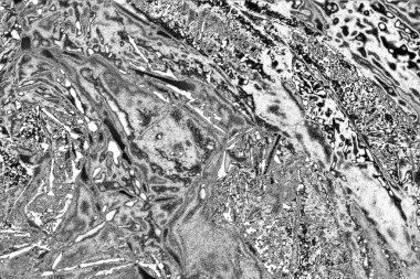 Çizik ve çatlaklarla dolu gri bir doku.