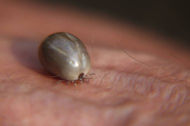 Castor fasulyesi kenesi (Ixodes ricinus)