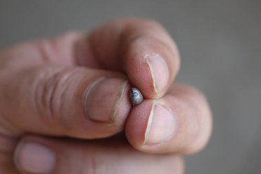 İnsan parmağında küçük bir tik.