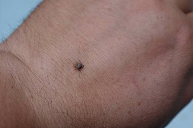 Castor fasulyesi kenesi (Ixodes ricinus)