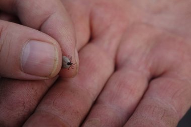 İnsan parmağında küçük bir tik.