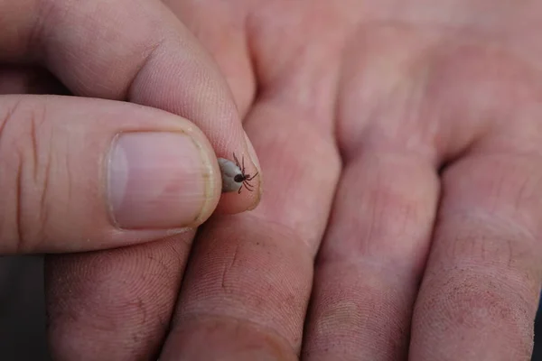 Маленький Клещ Человеческом Пальце — стоковое фото