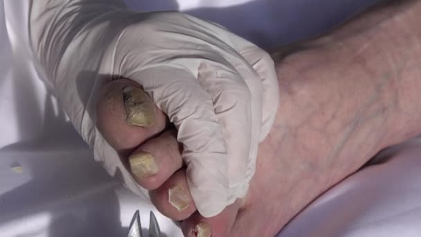 Kozmetik Uzmanı Yaşlı Bir Hastanın Ayak Tırnaklarını Kesiyor — Stok video