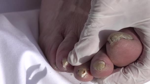 Cosmetólogo Cortando Las Uñas Los Pies Paciente Anciano — Vídeo de stock