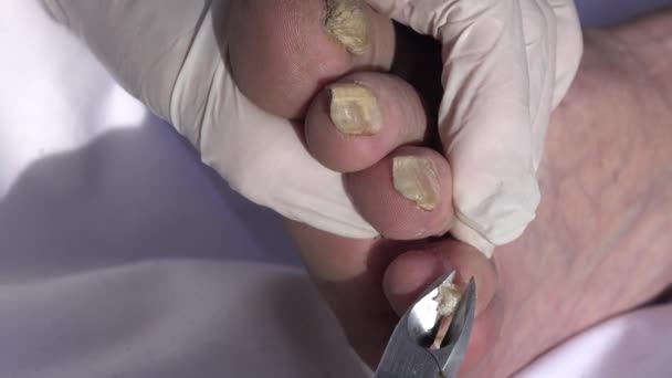 Cosmetologist Cutting Toenails Elderly Patient — Stock Video