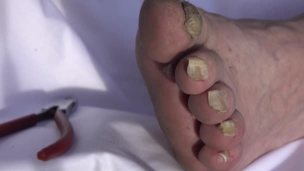 Kosmetolog Stříhající Nehty Nohou Staršího Pacienta — Stock video