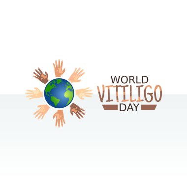 Dünya Vitiligo Günü 'nün vektör grafiği dünya vitiligo günü kutlaması için iyidir. düz dizayn. İlan tasarımı. Düz illüstrasyon.