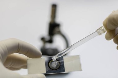 Beyaz lateks eldivenli bir bilimsel araştırmacının elleri, mikroskop altında incelenmek üzere bir örnek dökerken,.