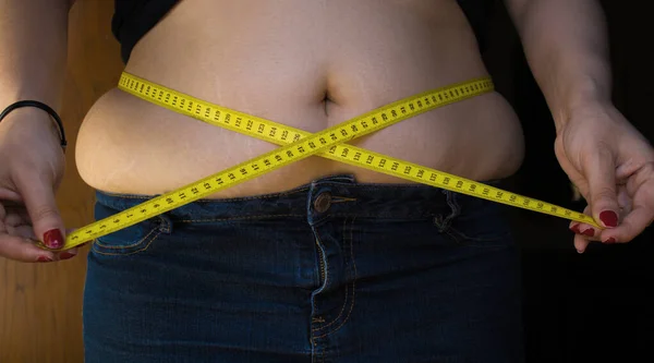 Una Foto Una Chica Gordita Con Una Cinta Métrica Alrededor Imágenes De Stock Sin Royalties Gratis