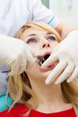 Doktor diş hekimi çıkarma yordamı hasta diş çıkarma Forseps ile uygulama