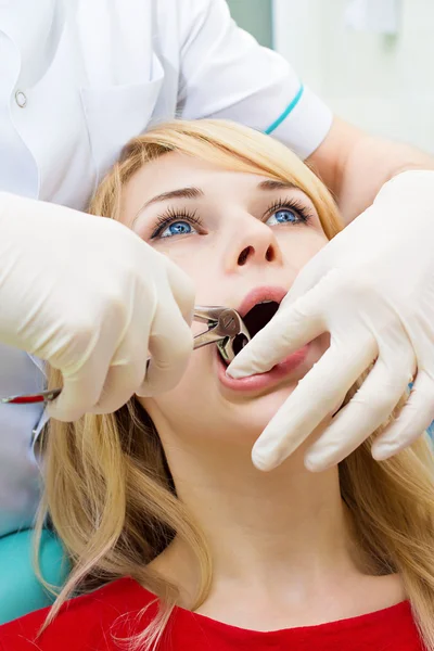 Doctor dentist performing extraction procedure with forceps removing patient tooth — Stock Photo, Image