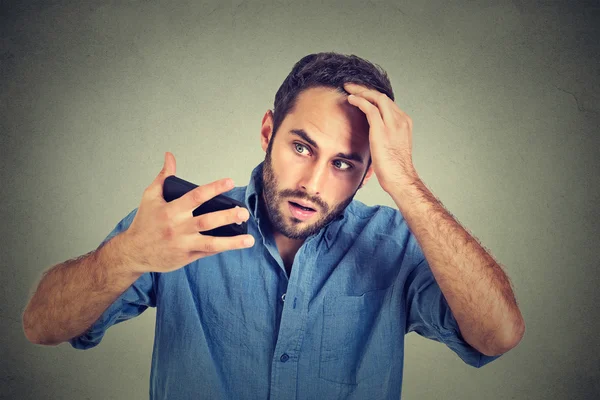 Portrait, shocked man feeling head, surprised he is losing hair, receding hairline — ストック写真