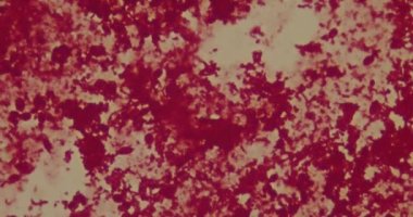 Hastanede mikroskop altında bakteriler