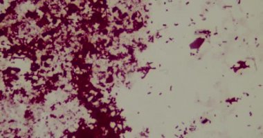 Hastanede mikroskop altında bakteriler