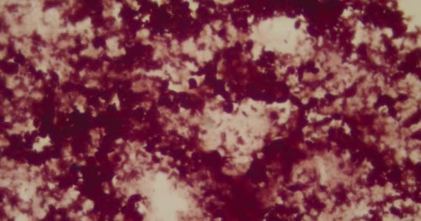 Bactérias sob um microscópio em um hospital — Vídeo de Stock