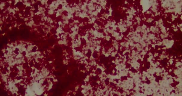 Bakterier under mikroskop på sjukhus — Stockvideo