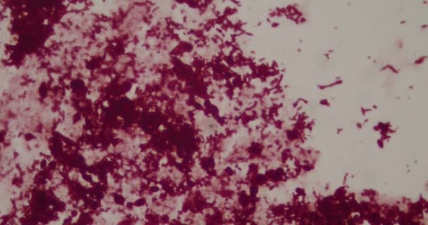 Bacterias al microscopio en un hospital — Vídeos de Stock