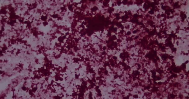 Бактерии под микроскопом в больнице — стоковое видео