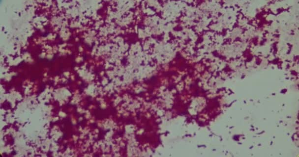 Bakterie pod mikroskopem w szpitalu — Wideo stockowe