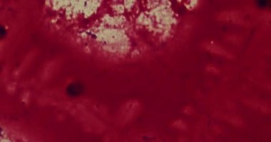 Hastanede mikroskop altında bakteriler