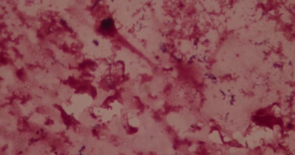 Бактерії під мікроскопом у лікарні — стокове відео