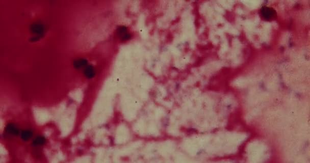 Hastanede mikroskop altında bakteriler — Stok video