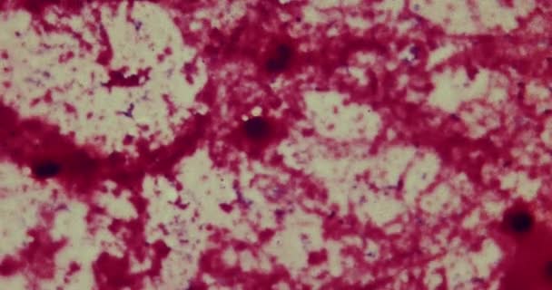 Бактерии под микроскопом в больнице — стоковое видео