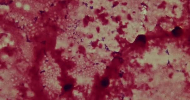 Bacterias al microscopio en un hospital — Vídeo de stock
