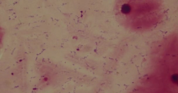 Bacteriën onder een microscoop in een ziekenhuis — Stockvideo