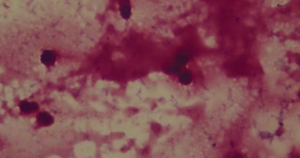 Batteri al microscopio in ospedale — Video Stock