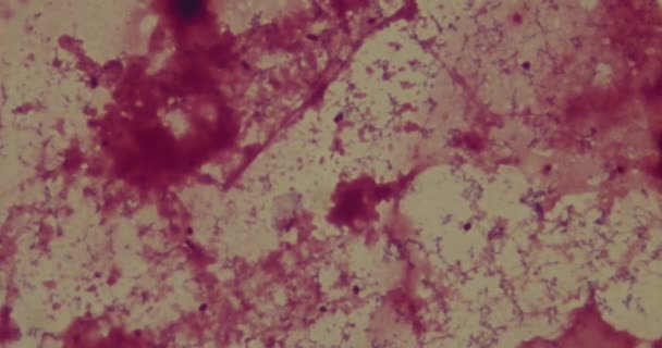Βακτήρια κάτω από μικροσκόπιο σε νοσοκομείο — Αρχείο Βίντεο