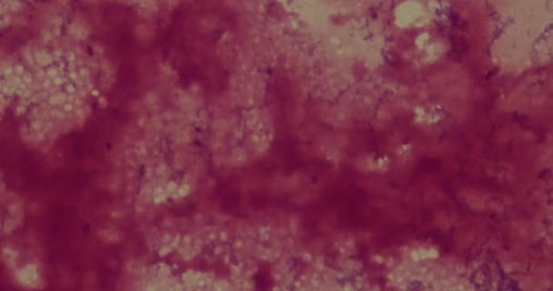 Bakterie pod mikroskopem v nemocnici — Stock video
