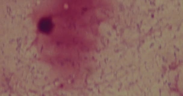 Bacterii sub microscop într-un spital — Videoclip de stoc