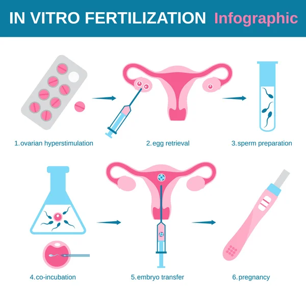 Em vitro — Vetor de Stock