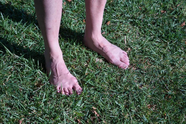 Detail Der Nackten Füße Eines Erwachsenen Mannes Auf Einer Parkwiese — Stockfoto