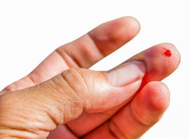 Diyabet testi için parmağa kan damlası ya da beyaz arka planda izole edilmiş kan şekeri, parmağa yakın plan, insan eli kesilmiş parlak kırmızı kanla yaralanmış..