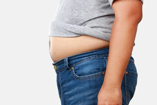 胖男人穿着灰白色的衬衫 体重减轻 脱下衬衫 露出大肚皮 有各种疾病的风险是存在的 减肥的概念 收割路径 — 图库照片