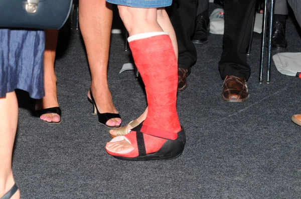 Person Plaster Cast Leg Injury — Stock Photo, Image