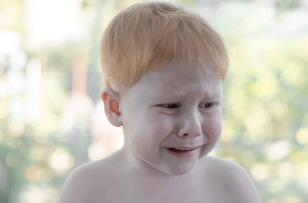 Niño Pelirrojo Está Llorando Niño Años Pierde Parque Llora — Foto de Stock