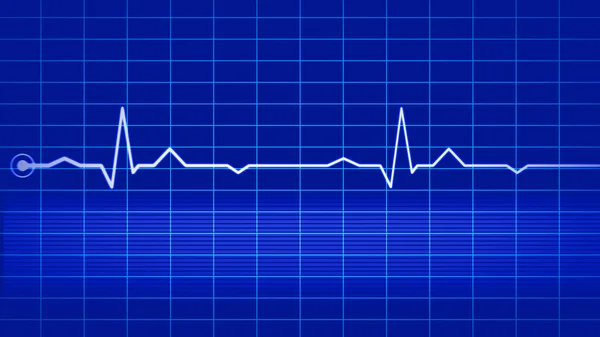 Elektrocardiogram op blauwe monitor — Stockfoto