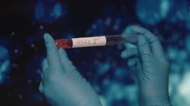 Eldivenli El H3N2 Virüs Testi için Kan Numunesi. Yüksek kalite 4k görüntü