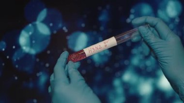 Eldivenli El H3N2 Virüs Testi için Kan Numunesi. Yüksek kalite 4k görüntü