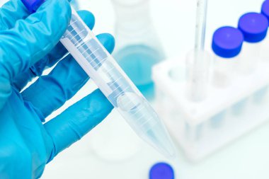 Mavi bir tıbbi eldiven, üzerinde mavi sıvı bulunan bir test tüpü taşır. Arka planda mavi sıvı bulunan bir tripod. Kimyasal teknoloji kavramı, biyoteknoloji, eczacılık.