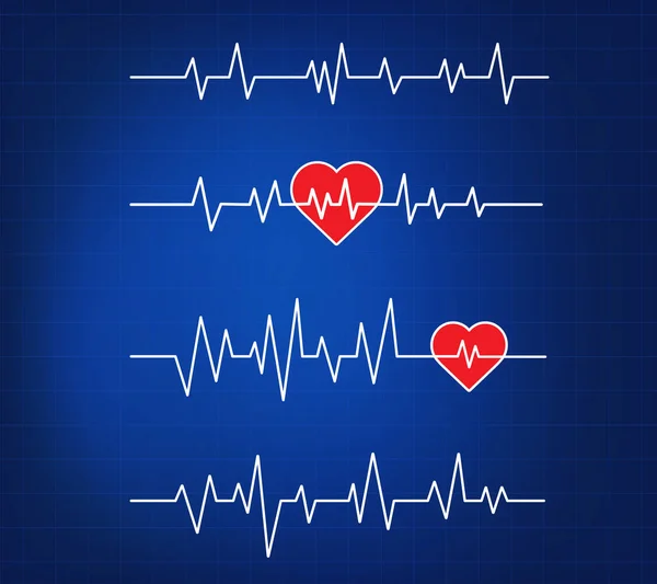 Batimento Cardíaco Ekg Linhas Isoladas Fundo Azul Monitor Pulso Eletrocardiograma —  Vetores de Stock